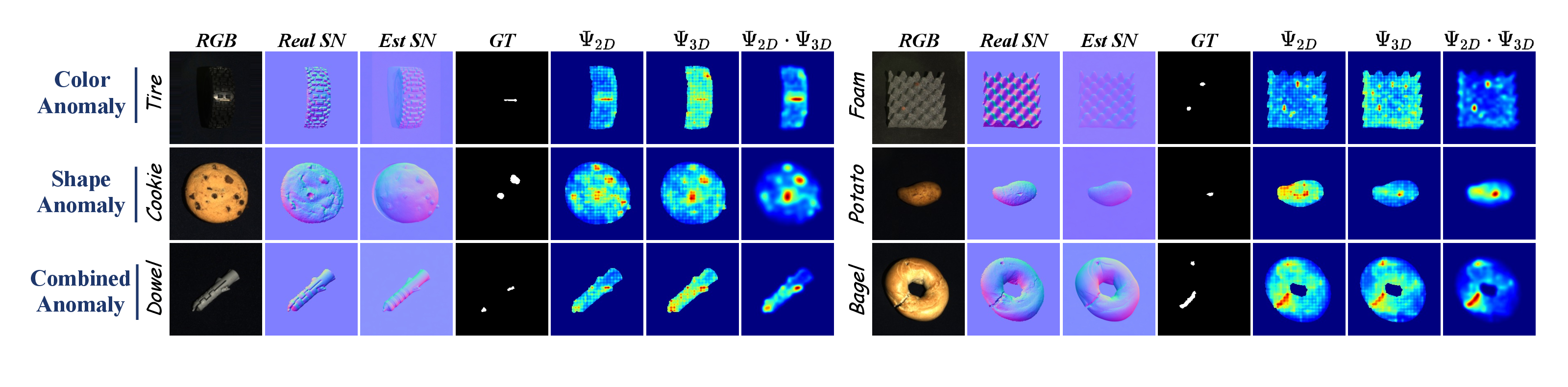 Qualitative examples showing RGB, real normals, estimated normals, and anomaly maps.
